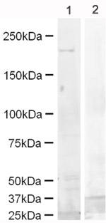 All lanes : Anti-EGFR antibody (ab15669) at 2 µg/mlLane 1 : mouse brain lysateLane 2 : mouse brain lysate with Mouse EGFR peptide (ab15739) at 1 µg/mlSecondaryAlexa Fluor Goat polyclonal to Rabbit IgG at 0.1 µg/mlPerformed under reducing conditions.