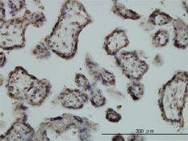 Egr1 antibody (ab54966) used in immunohistochemistry at 3ug/ml on formalin fixed and paraffin embedded human placenta.