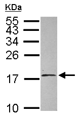 Anti-EIF1AY antibody (ab155546) at 1/500 dilution + Raji whole cell lysate at 30 µg