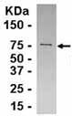 Anti-EIF2B2 antibody (ab37675) at 1/2000 dilution + E coli derived fusion proteinSecondaryGoat anti IgY HRP at 1/1000 dilutiondeveloped using the ECL technique