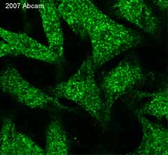 ab32157 at 1/100 staining human epithelial cells by ICC/IF. The cells were paraformaldehyde fixed and blocked with BSA before incubation with the antibody for 1 hour. An Alexa-Fluor ® 647 conjugated goat anti-rabbit IgG was used as the secondary.See Abreview