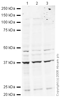 All lanes : Anti-EIF2S1 antibody (ab26197) at 1 µg/mlLane 1 : HeLa whole cell lysateLane 2 : Jurkat (Human T cell lymphoblast-like cell line) Whole Cell Lysate (ab7899)Lane 3 : A431 (Human epithelial carcinoma cell line) Whole Cell Lysate (ab7909)Lysates/proteins at 20 µg per lane.SecondaryGoat polyclonal to Rabbit IgG (Alexa Fluor® 680) at 1/10000 dilutionPerformed under reducing conditions.