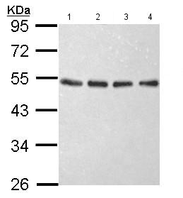 All lanes : Anti-EIF2S2 antibody (ab155649) at 1/1000 dilutionLane 1 : 293T whole cell lysateLane 2 : A431 whole cell lysateLane 3 : H1299 whole cell lysateLane 4 : HeLa whole cell lysateLysates/proteins at 30 µg per lane.