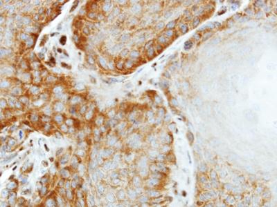 Immunohistochemical analysis of formalin-fixed, paraffin-embedded Human SG xenograft tissue, labeling EIF2S2 using ab155649 at a 1/500 dilution.