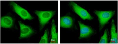 Immunofluorescence analysis of paraformaldehyde-fixed HeLa cells, labeling EIF2S2 using ab155649 at a 1/500 dilution. The image in the right panel was costained with Hoechst 33343.