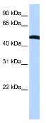 Anti-EIF2S2 antibody (ab74836) at 1 µg/ml (in 5% skim milk / PBS buffer) + HepG2 cell lysate at 10 µgSecondaryHRP conjugated anti-Rabbit IgG at 1/50000 dilution