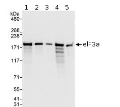 All lanes : Anti-eIF3A antibody (ab86146) at 0.04 µg/mlLane 1 : HeLa whole cell lysate at 50 µgLane 2 : HeLa whole cell lysate at 15 µgLane 3 : HeLa whole cell lysate at 5 µgLane 4 : 293T whole cell lysate at 50 µgLane 5 : NIH3T3 whole cell lysate at 50 µgdeveloped using the ECL technique