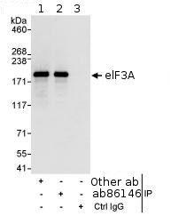 Detection of Human eIF3A by Immunoprecipitation, using ab86146 at 3µg/mg lysate. Image shows immunoprecipitated eIF3A detected with post IP WB, loading 20% of IP and using HeLa whole cell lysate at 1mg, with an antibody recognising an upstream epitope in lane 1, ab86146 at 1 µg/ml in lane 2 and control IgG in lane 3. Detection: Chemiluminescence with an exposure time of 3 seconds.