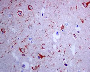 ab128996, at 1/50 dilution, staining eIF3A in paraffin-embedded Human brain tissue by Immunohistochemistry.