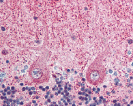 ab64177 at 2.5µg/ml staining EIF3F in human brain cerebellum by Immunohistochemistry, Formalin-fixed, paraffin-embedded tissue.