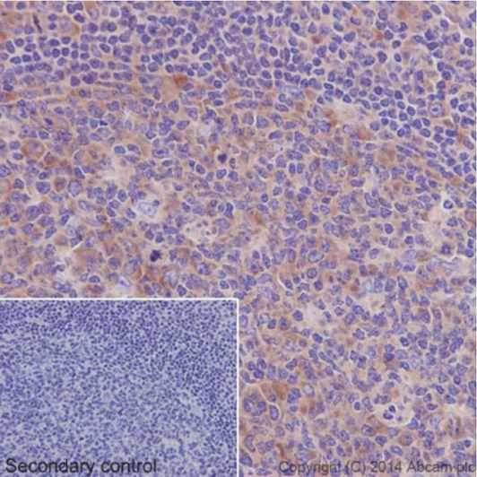 Immunohistochemical analysis of paraffin-embedded Human chronic tonsillitis tissue labeling EIF3S1 with ab196018 at 1/250 dilution, followed by Goat Anti-Rabbit IgG H&L (HRP) (ab97051) secondary antibody at 1/500 dilution. Cytoplasm staining on Human chronic tonsillitis tissue is observed. Counter stained with Hematoxylin.Secondary control: Used PBS instead of primary antibody, secondary antibody is Goat Anti-Rabbit IgG H&L (HRP) (ab97051) at 1/500 dilution.