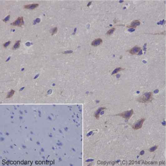 Immunohistochemical analysis of paraffin-embedded Rat cerebral cortex tissue labeling EIF3S1 with ab196018 at 1/250 dilution, followed by Goat Anti-Rabbit IgG H&L (HRP) (ab97051) secondary antibody at 1/500 dilution. Cytoplasm staining on Rat cerebral cortex is observed. Counter stained with Hematoxylin.Secondary control: Used PBS instead of primary antibody, secondary antibody is Goat Anti-Rabbit IgG H&L (HRP) (ab97051) at 1/500 dilution.