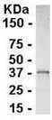 Anti-EIF3S2 antibody (ab37526) at 1/2000 dilution + E. coli derived fusion protein at 2.5 µgSecondaryGoat anti-IgY-HRP at 1/1000 dilution