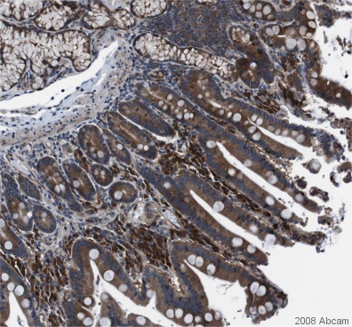 Image courtesy of Human Protein Atlas. ab31218 staining eIF4A2 in human duodenum, showing strong cytomplasmic staining in the villi and Brunner's gland cells. Paraffin embedded human duodenum tissue was incubated with ab31218 (1/400 dilution) for 30 mins at room temperature. Antigen retrieval was performed by heat induction in citrate buffer pH 6. ab31218 was tested in a tissue microarray (TMA) containing a wide range of normal and cancer tissues. Further results for this antibody can be found at www.proteinatlas.org