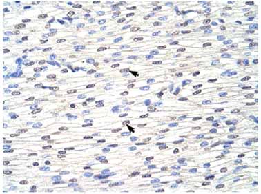 Immunohistochemistry (Formalin/PFA-fixed paraffin-embedded sections) analysis of human heart tissue labelling eIF4B with ab66780 at 4-8µg/ml. Arrows indicate positively labelled myocardial cells. Magnification: 400X.