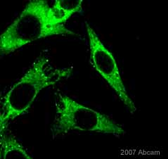 ab1126 at 1/100 staining human epithelial cells by ICC/IF. The cells were paraformaldehyde fixed and blocked with BSA prior to incubation with the antibody for 1 hour. An Alexa-Fluor ® 647 conjugated goat anti-rabbit IgG was used as the secondary.See Abreview