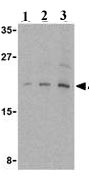 Lane 1 :  Anti-eIF4EBP1 antibody (ab25872) at 2.5 µg/mlLane 2 :  Anti-eIF4EBP1 antibody (ab25872) at 5 µg/mlLane 3 :  Anti-eIF4EBP1 antibody (ab25872) at 10 µg/mlLane 1 : Human brain cell lysateLane 2 : Human brain cell lysateLane 3 : Human brain cell lysate