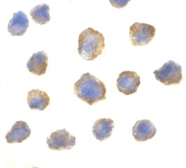 ab25872 at 2µg/ml staining elf4EBP1 in 3T3 cells by ICC/IF