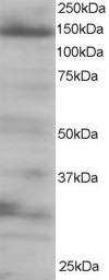 ab6034 at 0.25µg/ml staining approximately 140-150kDa band of EIF4ENIF1 in HEK293 Lysate by Western blot (ECL).