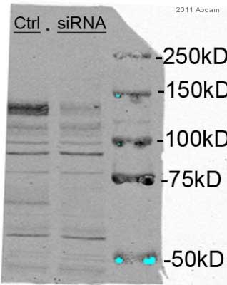 All lanes : Anti-eIF4ENIF1 antibody (ab55881) at 1/1000 dilutionLane 1 : Whole cell lysate prepared from HeLa cellsLane 2 : siRNA knockdownLysates/proteins at 10 µg per lane.SecondaryIRDye 800CW conjugated goat anti-rabbit polyclonal at 1/15000 dilution