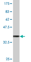 Anti-eIF4ENIF1 antibody (ab77027) at 1 µg/ml + recombinant human eIF4ENIF1 protein fragment with a 26 kDa tag at 0.1 µgSecondaryGoat Anti-Mouse IgG (H&L)-HRP Conjugate at 1/5000 dilution