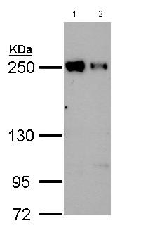 All lanes : Anti-eIF4GII antibody - N-terminal (ab155482) at 1/5000 dilutionLane 1 : Mouse JC whole cell lysateLane 2 : Mouse BCL-1 whole cell lysateLysates/proteins at 30 µg per lane.