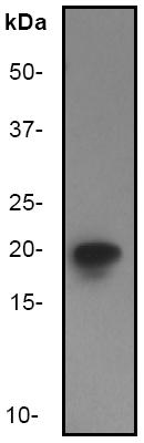 Anti-eIF5A antibody (ab32014) at 1/1000 dilution + Jurkat cell lysate