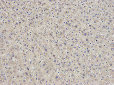 Immunohistochemistry (Formalin/PFA-fixed paraffin-embedded sections) analysis of human liver tissue labelling eIF5A with ab187177 at 1/200. Magnification: 200x.