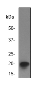 Anti-eIF5A antibody [EP526Y] (ab32443) at 1/10000 dilution + Jurkat cell lysate.