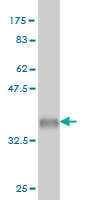 Western blot against tagged recombinant protein immunogen using ab57421 eIF5A2 antibody at 1ug/ml. 