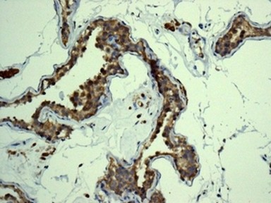 Immunohistochemical analysis of paraffin-embedded Human testis tissue labelling eIF5A2 with ab150439 at 1/100 dilution.