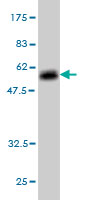 Western blot against tagged recombinant protein immunogen using ab56564 Elastase 3A antibody at 1ug/ml.