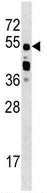 Anti-Elav-type RNA-binding protein ETR3 antibody (ab130727) at 1/100 dilution + Jurkat cell lysate at 35 µg