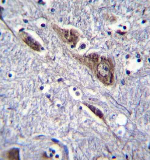 Immunohistochemical analysis of formalin-fixed, paraffin-embedded Human brain tissue labeling ELAVL2 with ab171414 at 1/10 dilution, followed by peroxidase conjugation of the secondary antibody and DAB staining.