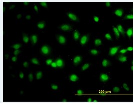 Immunofluorescent analysis of ab88087 on HeLa cell. Antibody concentration 10 µg/ml.