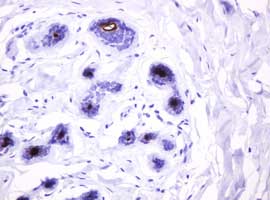 Immunohistochemical analysis of paraffin-embedded Human breast tissue labeling EMA with ab156947 at 1/150 dilution.