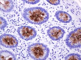 Immunohistochemical analysis of paraffin-embedded Human colon tissue labeling EMA with ab156947 at 1/150 dilution
