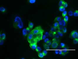 Immunofluorescent analysis of MCF7 cells labeling EMA using ab156947 at 1/100 dilution.