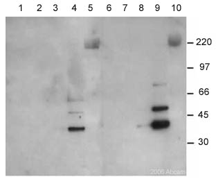 Lanes 1, 2, 3, 4, 6, 7, 8 & 9 :  Anti-EMAP II antibody [546-2] (ab15693) at 1/1000 dilutionLane 5 : Lane 10 : Lane 1 : HeLa Cytoplasmic Extract (0.625ug)Lane 2 : HeLa Cytoplasmic Extract (1.25ug)Lane 3 : HeLa Cytoplasmic Extract (2.5ug)Lane 4 : HeLa Cytoplasmic Extract (5ug)Lane 5 : High Range Rainbow MWMsLane 6 : HeLa Nuclear Extract (0.625ug)Lane 7 : HeLa Nuclear Extract (1.25ug)Lane 8 : HeLa Nuclear Extract (2.5ug)Lane 9 : HeLa Nuclear Extract (5ug)Lane 10 : High Range Rainbow MWMsSecondaryLanes 1, 2, 3, 4, 6, 7, 8 & 9 : HRP conjugated Sheep anti-mouse IgG