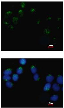 ab127692, at a dilution of 1/500, staining Embigin homolog in methanol-fixed A431 cells by Immunofluorescence. The lower image was co-stained with Hoechst 33342.