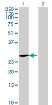 All lanes : Anti-EMG1 antibody (ab70509) at 1/500 dilutionLane 1 : EMG1 transfected 293T lysateLane 2 : Non transfected 293T lysateLysates/proteins at 25 µg per lane.SecondaryGoat Anti-Mouse IgG (H&L)-HRP Conjugate at 1/2500 dilution