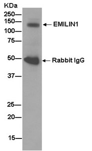 Western blot analysis of immunoprecipitation pellet from Human fetal kidney tissue lysate labeling EMILIN1 with ab185953 at a 1/50 dilution. Secondary ab: Goat Anti-Rabbit IgG, (H+L), Peroxidase conjugated, at a 1/1000 dilution.