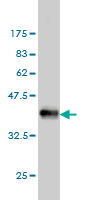 Western blot against tagged recombinant protein immunogen using ab55183 EMP3 antibody at 1ug/ml.