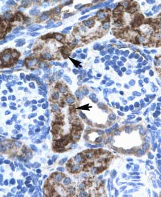 Ab28731, at a dilution of 4.0-8.0 µg/ml, staining EN2 in paraffin embedded human kidney tissues by Immunohistochemistry. Cells with positive label: epithelial cells of renal tubule (indicated with arrows). Magnification: 400X.