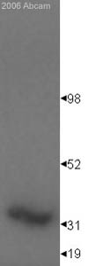 Anti-EN2 antibody (ab28731) at 1/1000 dilution + Human renal tumor nuclear cell lysate at 30 µgSecondaryAlkaline phosphate conjugated goat anti-rabbit polyclonal antibodydeveloped using the ECL techniquePerformed under reducing conditions.