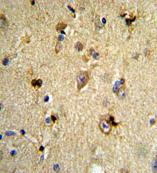 Immunohistochemical analysis of formalin fixed, paraffin embedded Human brain tissue labeling EN2 with ab176010 at a 1/50 dilution, followed by peroxidase conjugation of the secondary antibody and DAB staining.