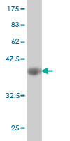 Western blot against tagged recombinant protein immunogen using ab57124 Enah/Vasp-like antibody at 1ug/ml.