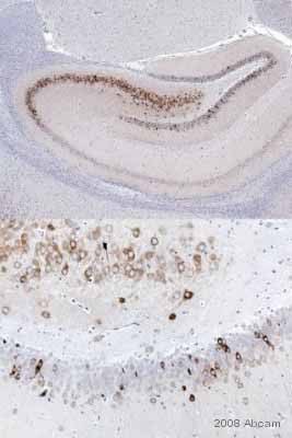ab15191 staining mouse brain sections by IHC-P.  Sections were formaldehyde fixed and subjected to heat mediated antigen retrieval in citrate buffer prior to blocking with 1% BSA for 10 minutes at RT.  The primary antibody was diluted 1/2000 and incubated with the sample for 2 hours.  A biotinylated goat anti-rabbit IgG antibody, diluted 1/300, was used as the secondary. Sections were preblocked in an Avidin-Biotin kit to mask endogenous biotinSee Abreview