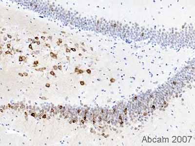 ab15191 staining adult rat hippocampus tissue sections by IHC-P.  Sections were formaldehyde fixed and subjected to heat mediated antigen retrieval (in citric acid, pH6, 10mM) prior to blocking in 1% BSA for 10 minutes at RT.  The primary anitbody was diluted 1/400 and incubated with the sample for 2 hours.  A biotinylated goat anti-rabbit antibody, diluted 1/300 was used as the secondary.Clear cytoplasmic staining in a subset of neurones in the dentate gyrus of a sagittal section of whole rat brain can be seen.  In other areas of this section, there are, additionally, small cells and their processes that are positive: they may be inter-neurones or microglia: it would be neccessary to carry out double-immunostaining to confirm this.See Abreview