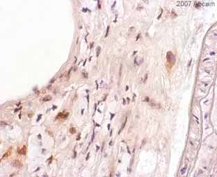ab15191 staining tissue sections of arteriosclerotic plaque in mouse aorta by IHC-Fr.  Sections were acetone fixed and blocked in 1% serum for 10 minutes at 20°C prior to incubation with the primary antibody (diluted 1/500) for 1 hour at 20°C.  A biotinylated donkey anti-rabbit antibody (diluted 1/500) was used as the secondary. See Abreview